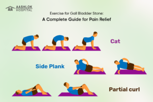 Exercise for Gall Bladder Stone: A Complete Guide for Pain Relief