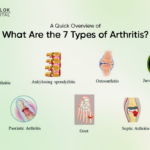 What Are the 7 Types of Arthritis? A Quick Overview