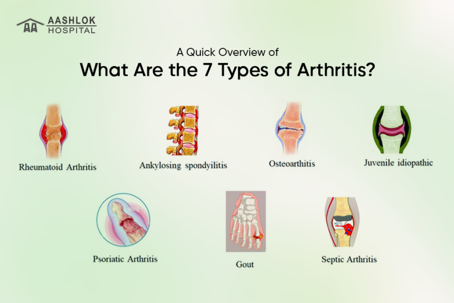 What Are the 7 Types of Arthritis? A Quick Overview