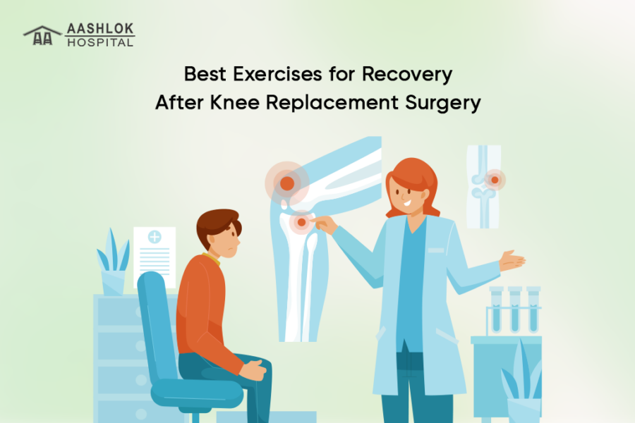 Best Exercises for Recovery After Knee Replacement Surgery