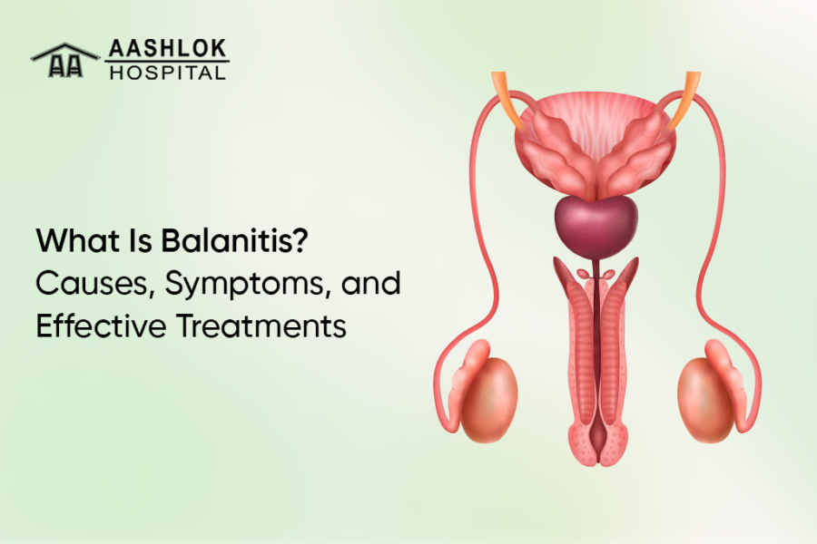 What Is Balanitis? Causes, Symptoms, and Effective Treatments